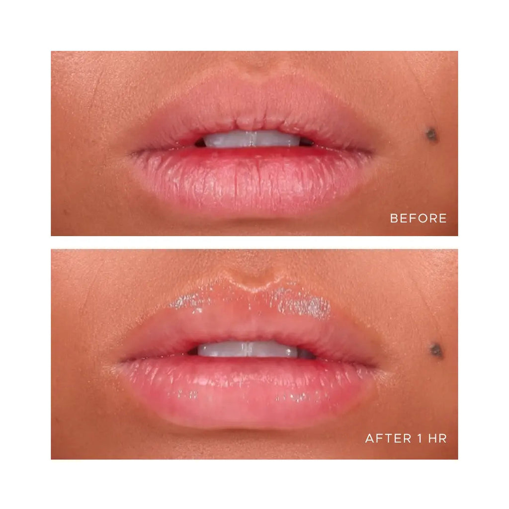 ANFISA - ÂN-GLOSS Ceramide Lip Treatment - Original