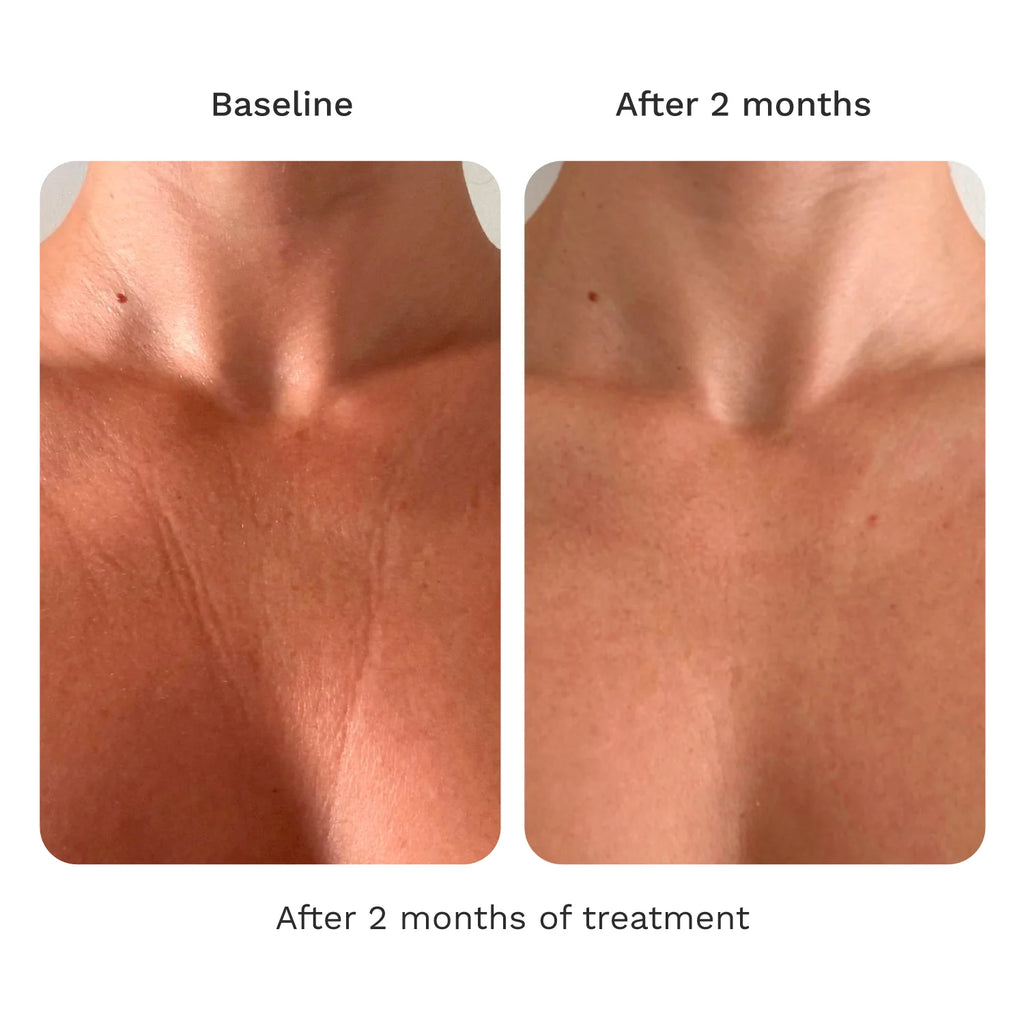 Adipeau Strength Gel