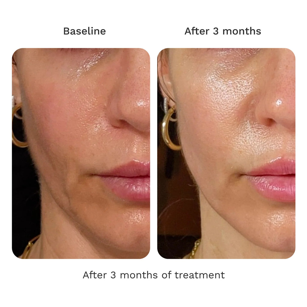 Adipeau Strength Gel