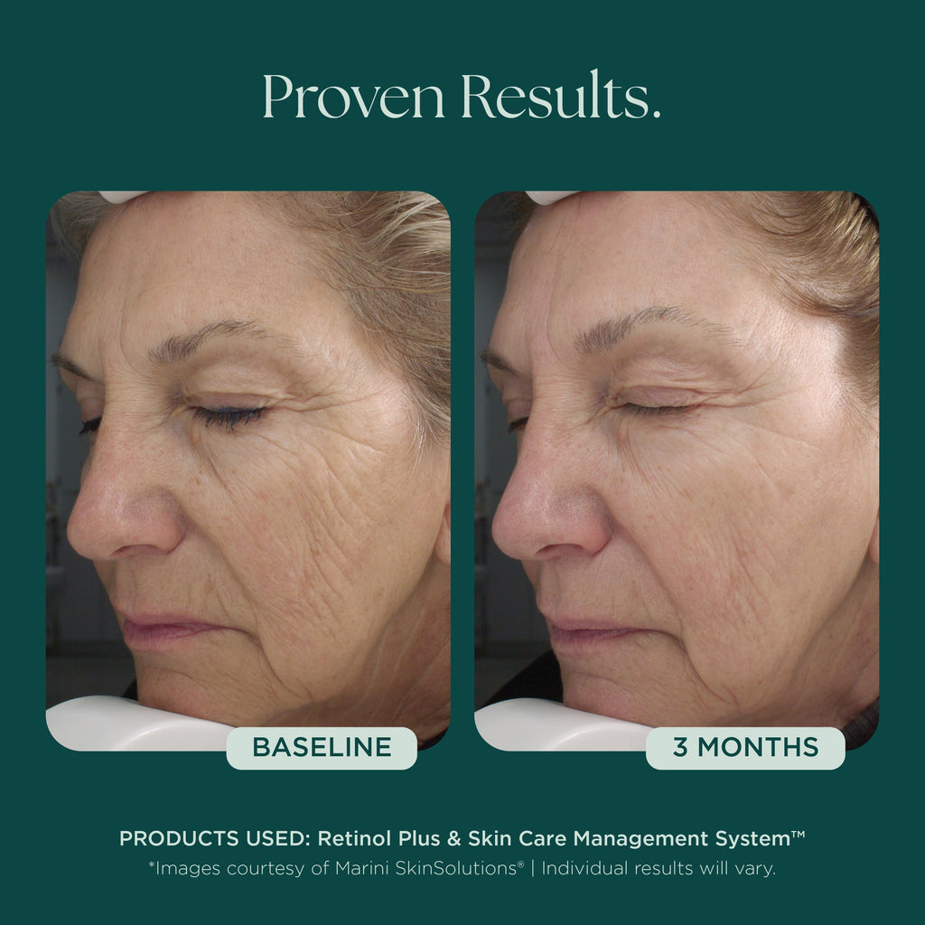 Marini Skin Solutions - Retinol Plus